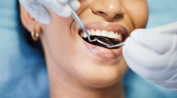 Best Emergency Dental Care for Sports Injuries in Marysville, WA