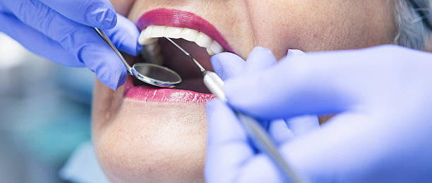 Best Emergency Treatment for Oral Infections in Marysville, WA